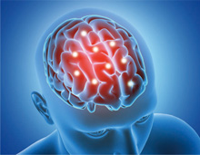 Protygold®（プロティゴールド®）の概要